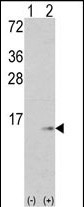 WB - S100A6 Antibody (C-term) AP7346b